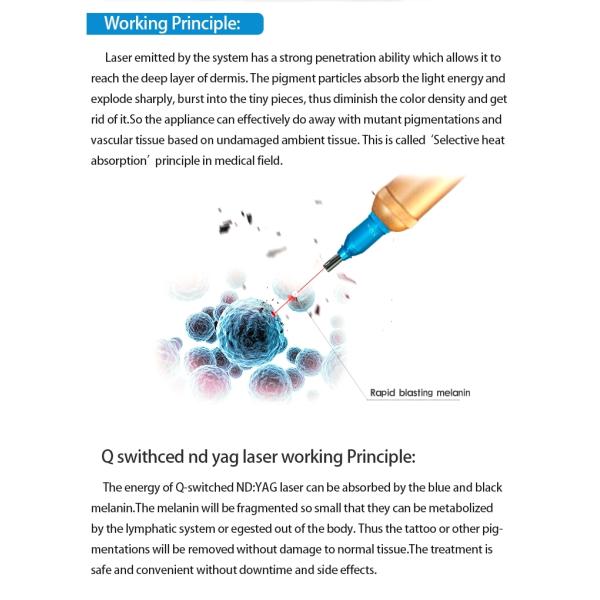 Q Switch 1064 532 ND YAG Laser Tattoo Removal Carbon laser peel peeling machine