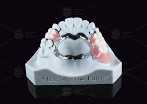 Buy cheap Removable Metal Acrylic Partial Denture With Clasps For Partial Chewing product