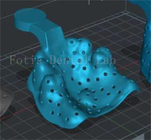 Customizable Dental Design Service Enamel Enhancement Program