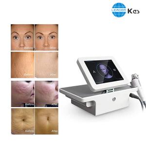 China Skin Tightening ISO13485 2MHz - 4MHz Microneedle Rf Machine on sale