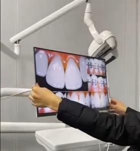 China Wall Mount Dental Desktop Computer Monitor 21.5 Inch White LCD LED Screen Display Monitor Intra Oral Camera on sale