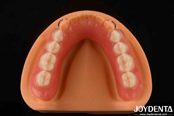 Quality Personalized Customization Acrylic Denture Finish Lightweight High Elasticity for sale