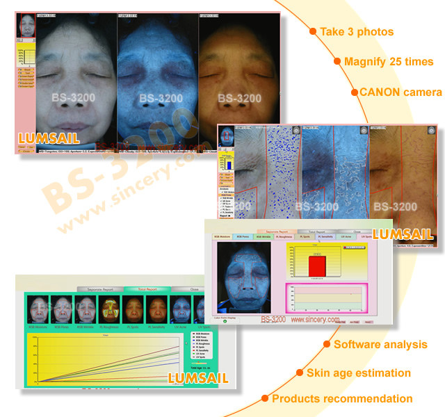 7200 K 3d Epidermal Skin Analysis Machine With English Version Software