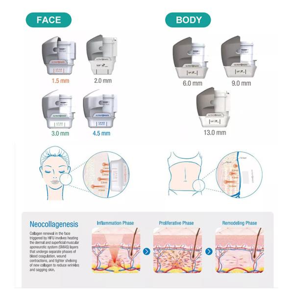 3d 4d 5d 7d 8d Hifu Slimming Machine Face Lifting Anti Wrinkle
