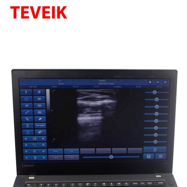 New arrival Mini USB Ultrasound Probe U10C3.5 for Android and windows