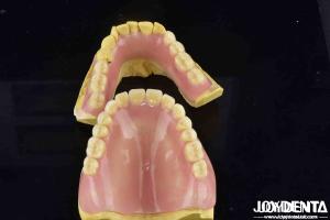 Unleash Potential Of Your Dental Practice Acrylic Denture Finish With Diverse And Lightweight Property