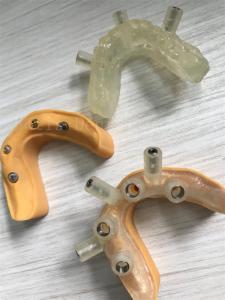 High Strength Teeth Artificial Crown For Implants Unmatched And Durability