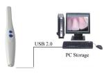Digital Scope ENT Scope Digital Intra Oral Camera with USB Connected to Computer