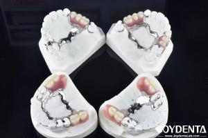 Elaborate Technology Framework Set Up Teeth Finish for Stable Oral Structure