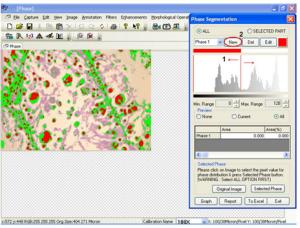 Metallurgical Image Analysis Measuring Software With Edge Detection