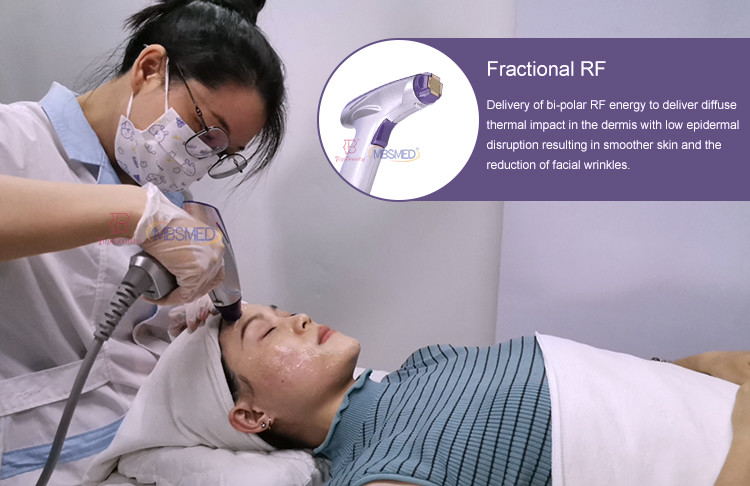 Best Wrinkle Remover Microneedling Rf Fractional Face Radio Frequency Machine