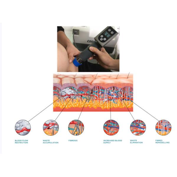 COOL WAVE Cryotherapy Slimming Machine /Fat Freezing Cryolipolyse Equipment With Shockwave Cellulite Removal