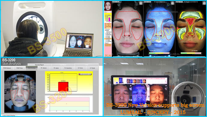 7200 K 3d Epidermal Skin Analysis Machine With English Version Software