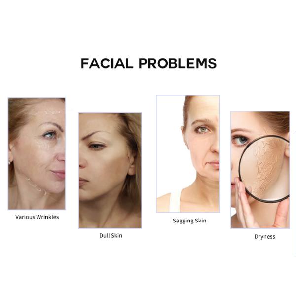 RF EMS Electric Vibrating Facial Massager Personal Care Skin Lifting