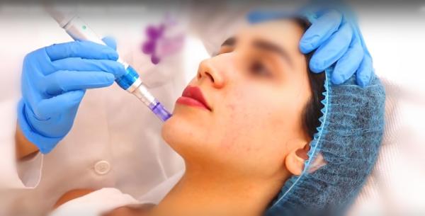 Quality Female Non Cross Linked HA Dermal Filler Deeply Skin Repairing Solution for sale
