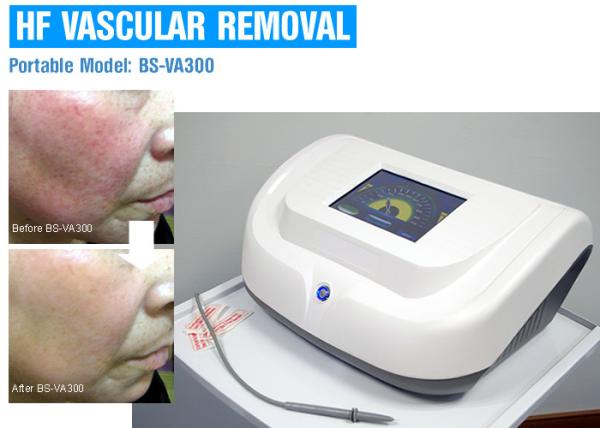 High Frequency Red Blood Vascular Removal Machine With Pulse / Continuous Work