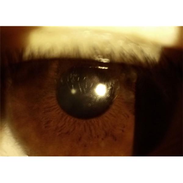 Wireless Printing Wifi 80mm Ophthalmic Device