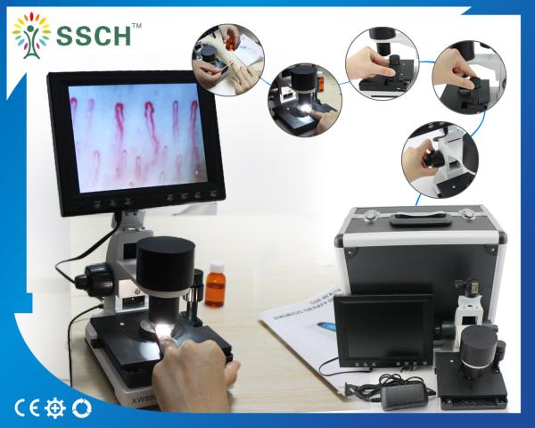 Quality Portable Video Microcirculation Microscope Nailfold Capillary with CE for sale