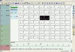 OLED display 48 Hours Recorder TLC6000 Dynamic 12 Lead ECG Holter Systems