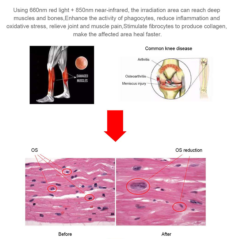 PBM Red LED Light Therapy Bed Photodynamic Machine For Fatigue Treatment