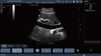 Pocket Wireless Hand Ultrasound Machine Android Windows IOS System Available