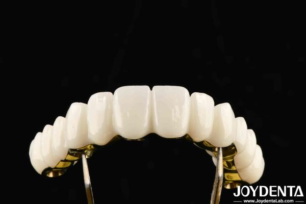 Quality Custom Made Zirconia Excellent Strength For Individualized Dental Solutions for sale