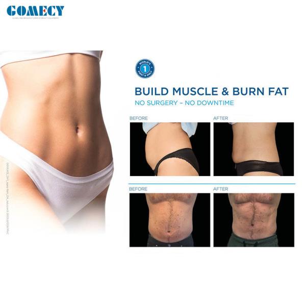 Portable Emslim Body bodyshaping Machine 100Hz With 4 Handles