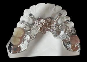 Buy cheap Customizable Cast Partial Removable Denture With Acrylic Resin / Metal Base Design product