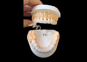 Enhanced Translucency Zirconia Dental Crown For Single / Multi Unit Fixed Restorations