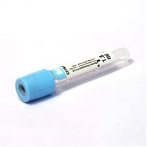China Serum Light Blue Top Edta Blood Test Tube Serum Separator on sale
