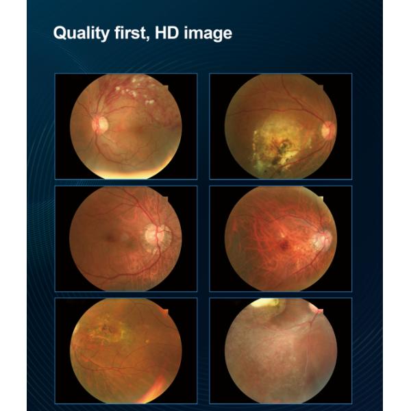 Non Mydriatic Fundus Camera with Diopter Compensation ±25D 9-position Mosaic Function and 100-240v 50/60HZ Power Supply