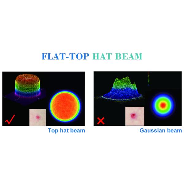 Hottest pigmentation removal pico second laser
