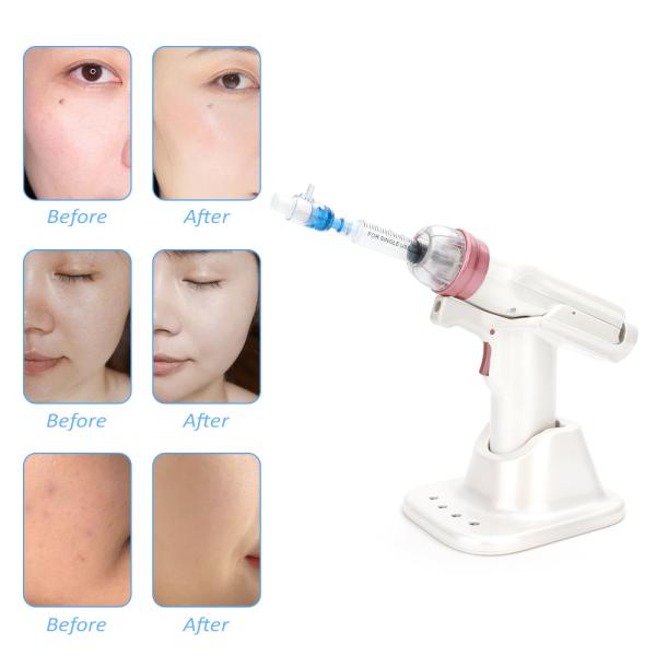Mesotherapy RF Beauty Machine 1.5'' OLED Meso Injector Gun 5 Level