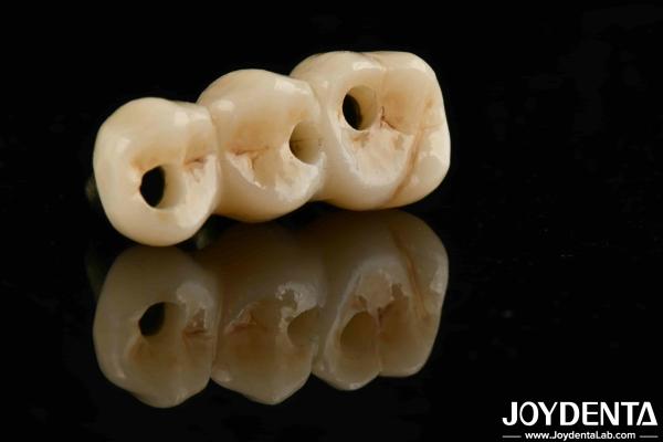 Quality Excellent Biocompatibility And High Strength Color Realistic Full Zirconia For B2B Procurement Solutions for sale