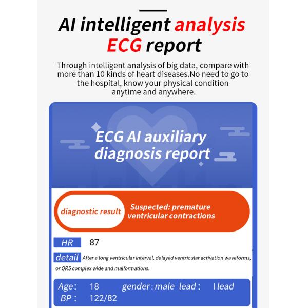 1.28 Inch Round Touch Screen ECG Smart Watch Wifi Music Control