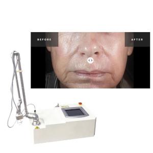 Buy cheap Portable 15w Co2 Fractional Acne Surgical Scar Laser Machine product