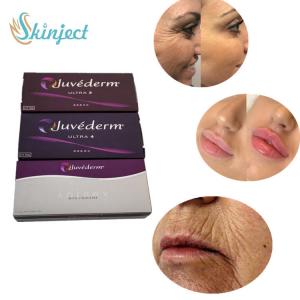 Buy cheap Juvederm Ultra 4 Dermal Filler Lip Injections For Sexy Lips Enhancement product