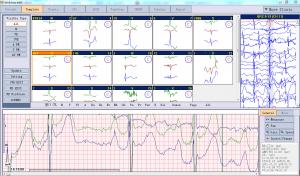 China PC Based ECG Holter Monitoring System 24 Hours Ambulatory Recording iTengo on sale