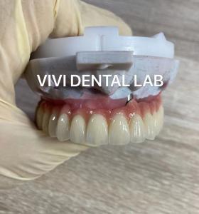China Scheftner Ivoclar Porcelain Fused Metal Crowns Dental SLM Technique on sale