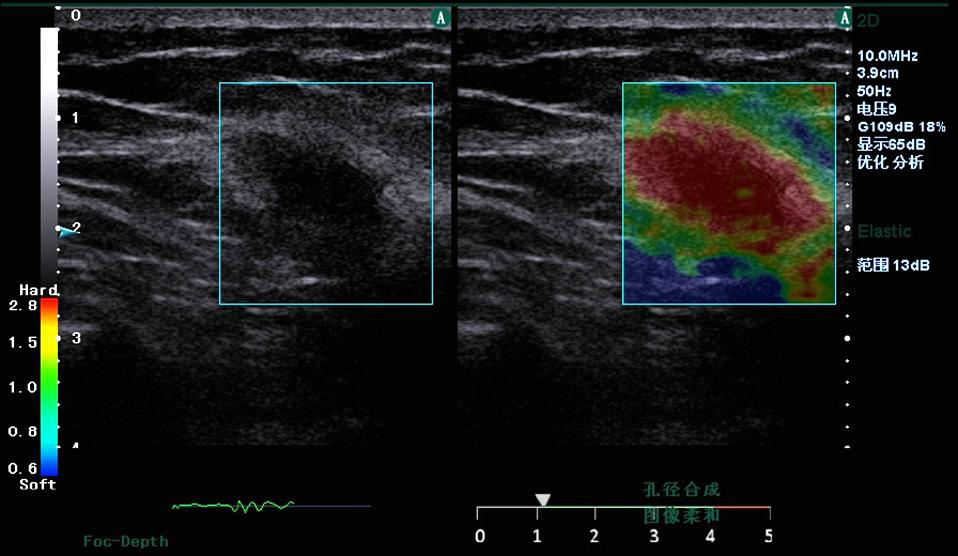 Healthcare Trolley Ultrasound Scanner System Clear Image Stable Performance