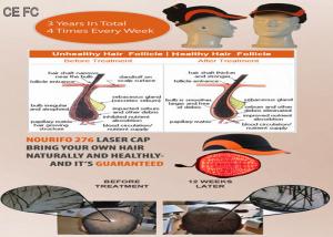 China Hair Loss System Helmet Cold Laser Hair Growth Cap for Hair Growth Faster on sale