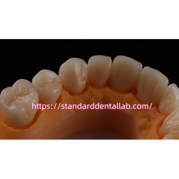 Layered Dental Zirconia Crown And Bridge Translucency 3D PRO Zirconia Porcelain Crown Standard Dental Lab