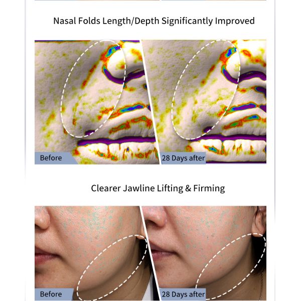 RF EMS Electric Vibrating Facial Massager Personal Care Skin Lifting