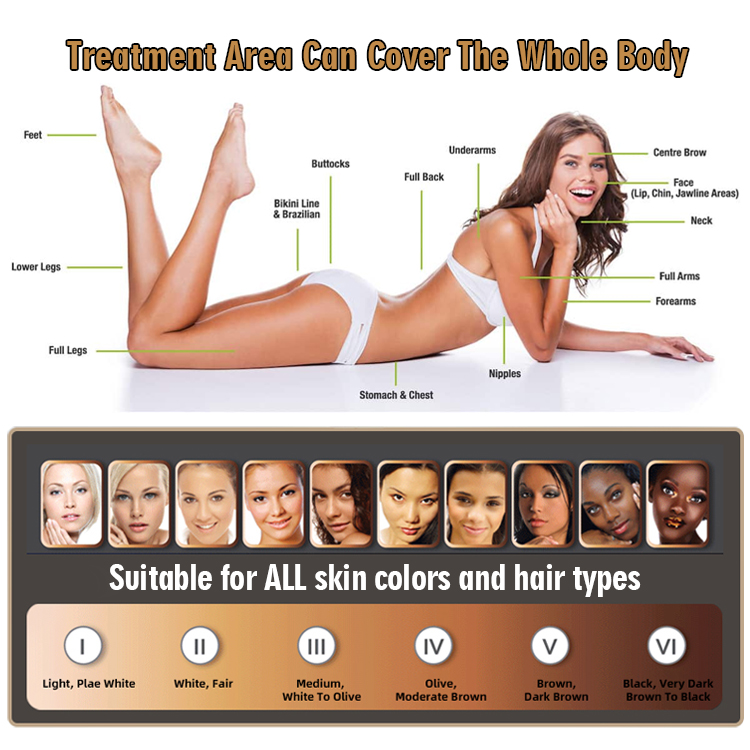 IPL Treatment