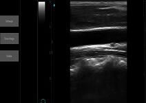 B Ultrasound Scanner Portable Ultrasound Scanner with B, B+B, B+M Mode USB Connection