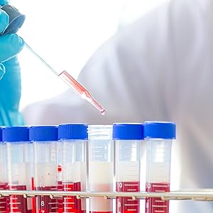 Conical Centrifuge Tubes 15mL, Sterile Plastic Test Tubes With Screw Caps, Polypropylene Container With Graduate