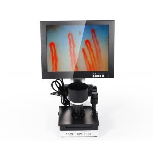China LCD Digital Biological Microscope Microcirculation Checking Capillary Microscope on sale