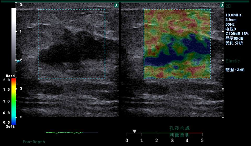 Healthcare Trolley Ultrasound Scanner System Clear Image Stable Performance