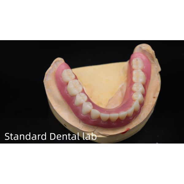 Titanium Implant Supported Dentures Precise Ivoclar Denture Over Implants