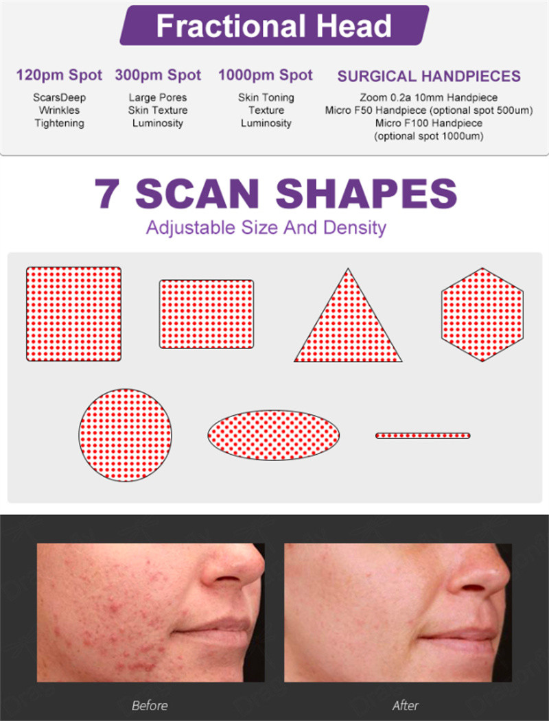 3 In 1 Fractional Co2 Laser Machine Skin Care Vaginal Tightening